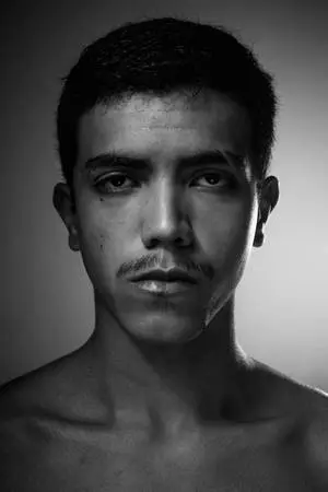 Man With A Scar Black And White Portrait